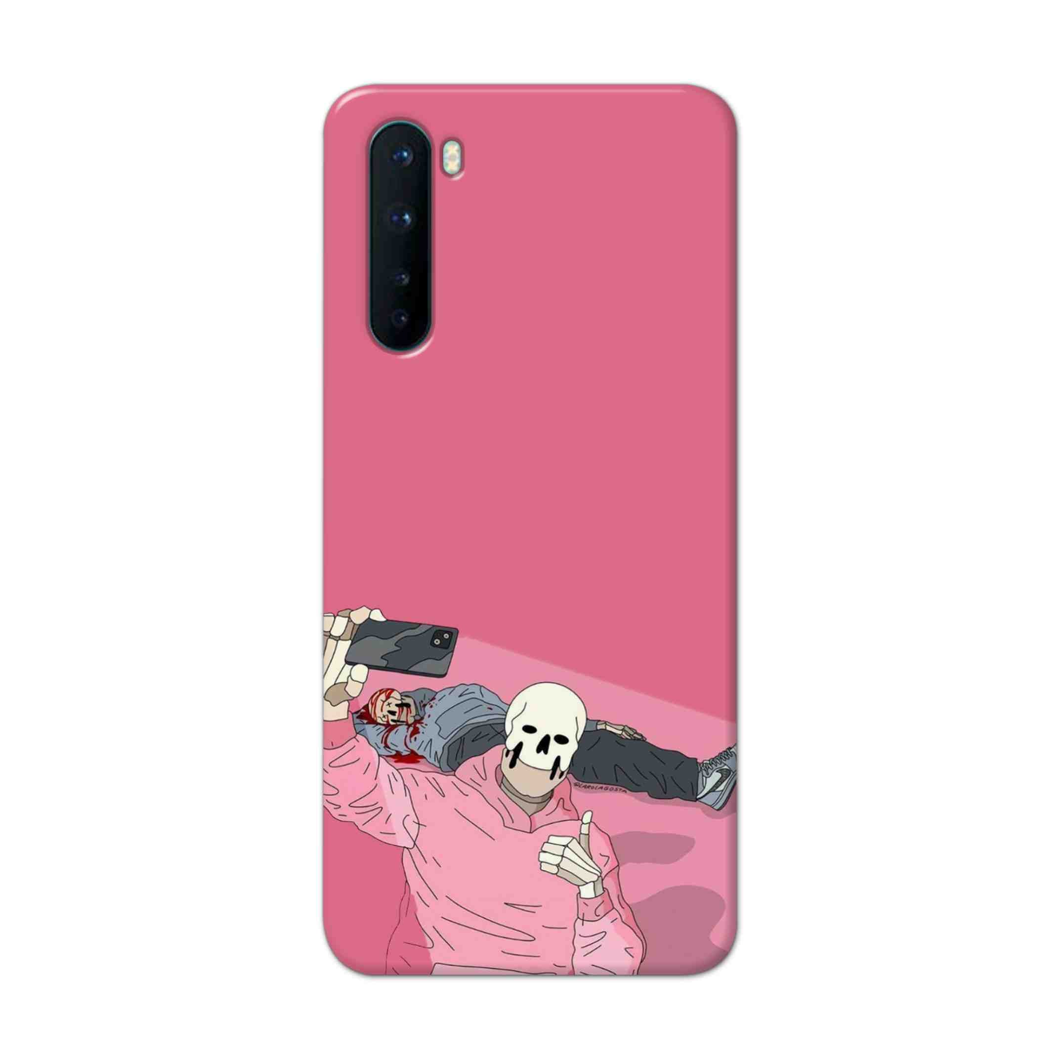 Buy Selfie Hard Back Mobile Phone Case Cover For OnePlus Nord Online