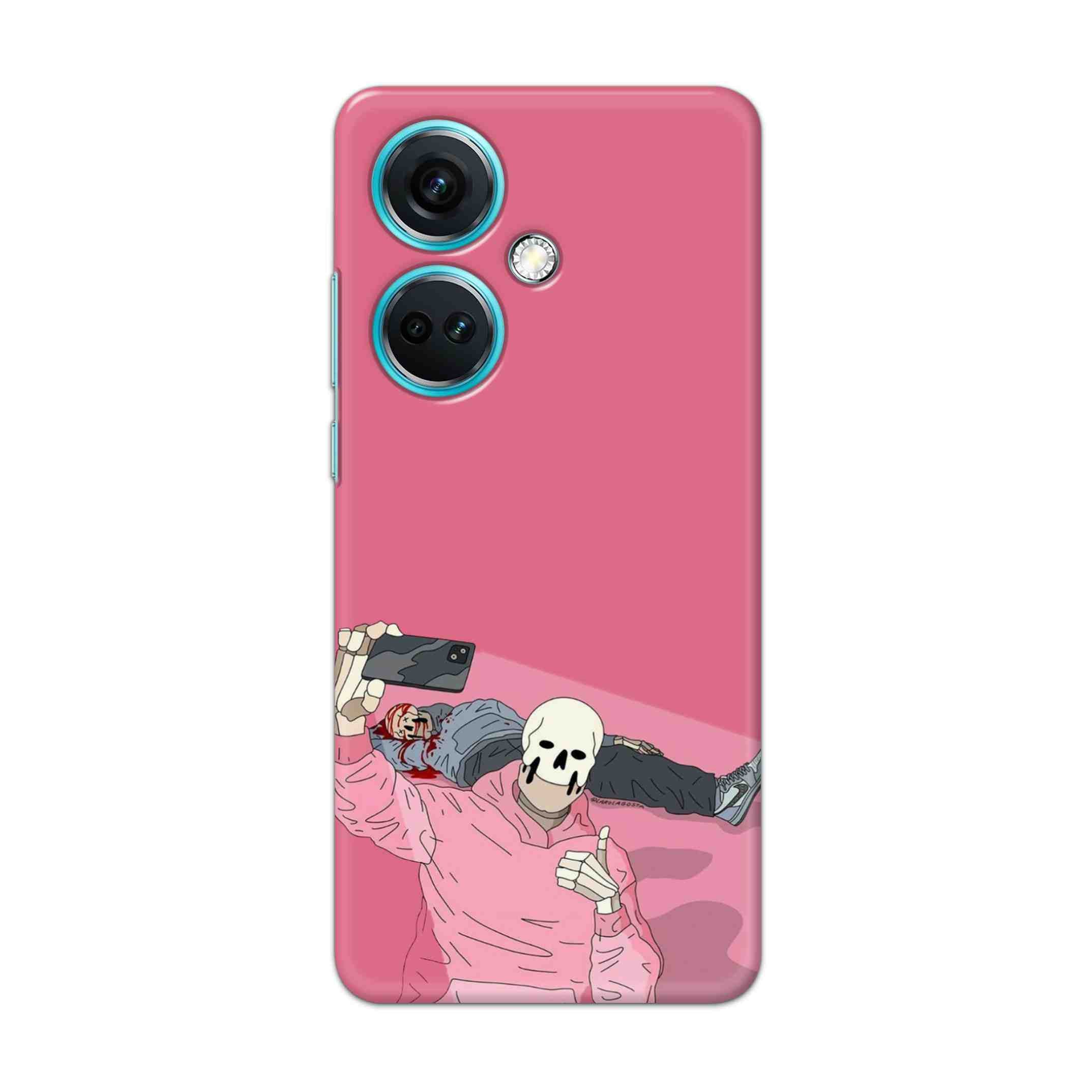 Buy Selfie Hard Back Mobile Phone Case/Cover For OnePlus Nord CE 3 5G Online