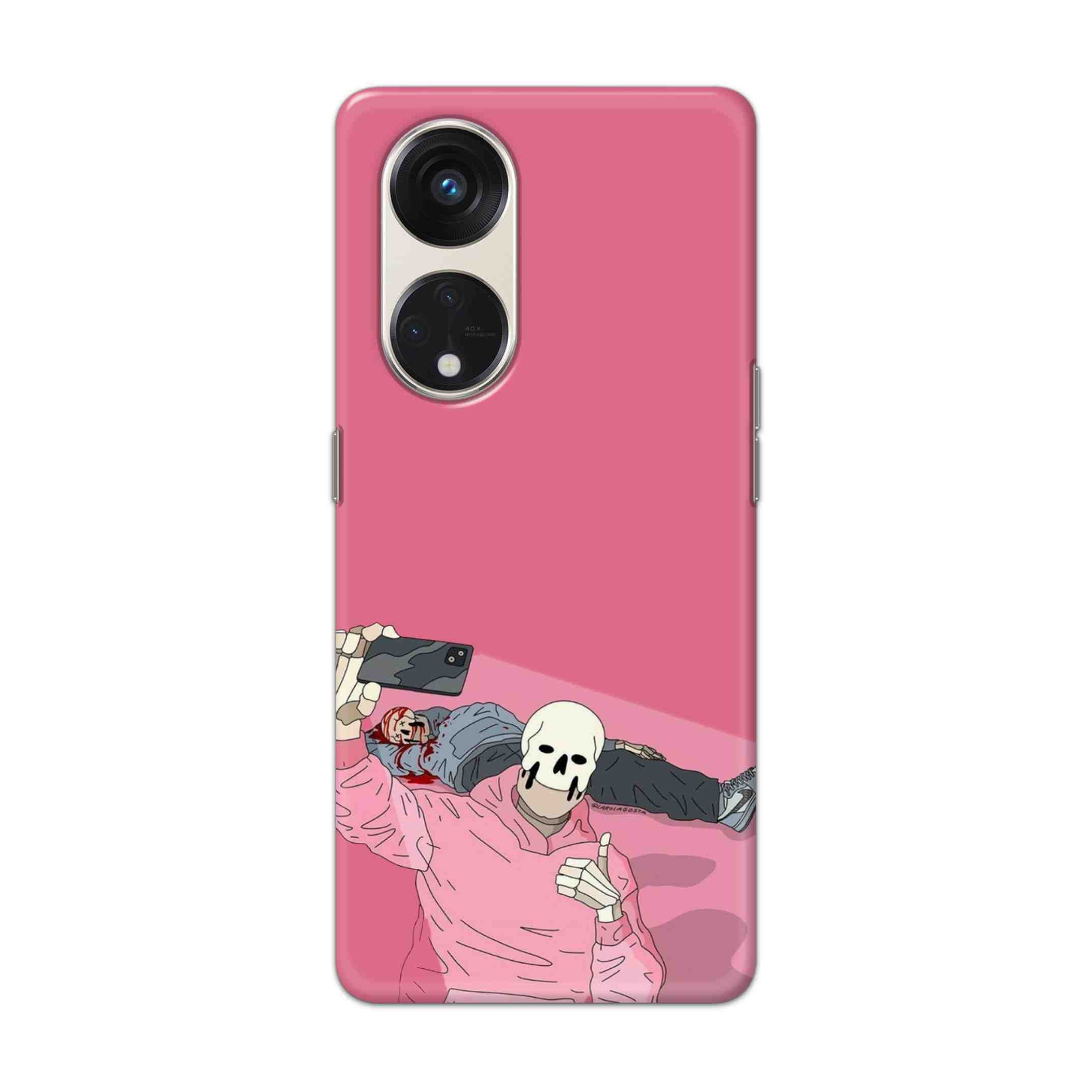 Buy Selfie Hard Back Mobile Phone Case/Cover For Oppo Reno 8T 5g Online